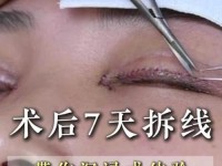 二个上面一个b过程,二次全切恢复过程