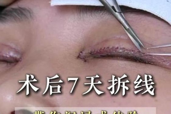 二个上面一个b过程,二次全切恢复过程